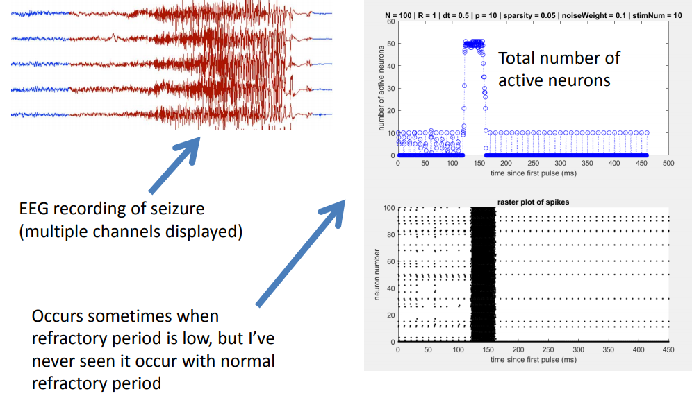 image of seizure-like observations